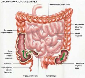 Илеоцекальный клапан кишечника симптомы